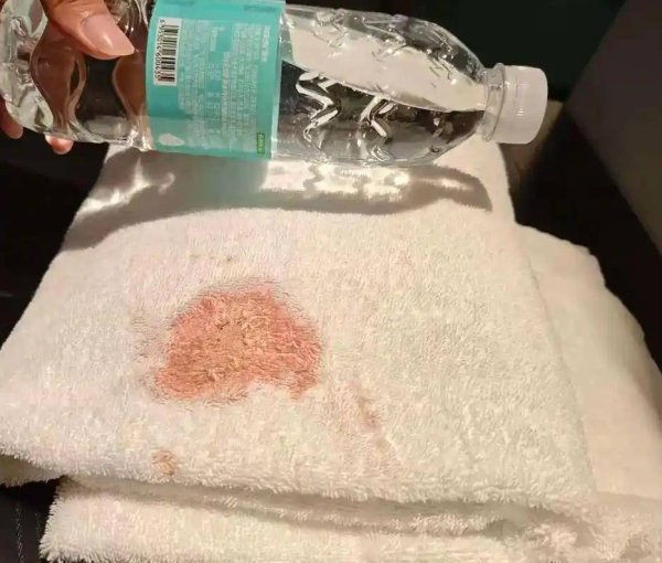 同花易配 极目锐评丨希岸酒店浴巾上出现大片血迹，到底是谁的责任？